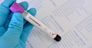 В Запорожье зафиксировано 375 случаев COVID-19