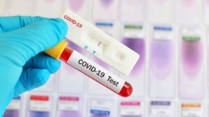 Коронавирус в Запорожской области: +3 случая за последние сутки