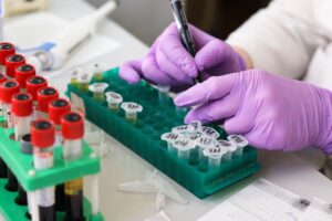 SARS-CoV-2 не является исключительно респираторным вирусом, – исследование 