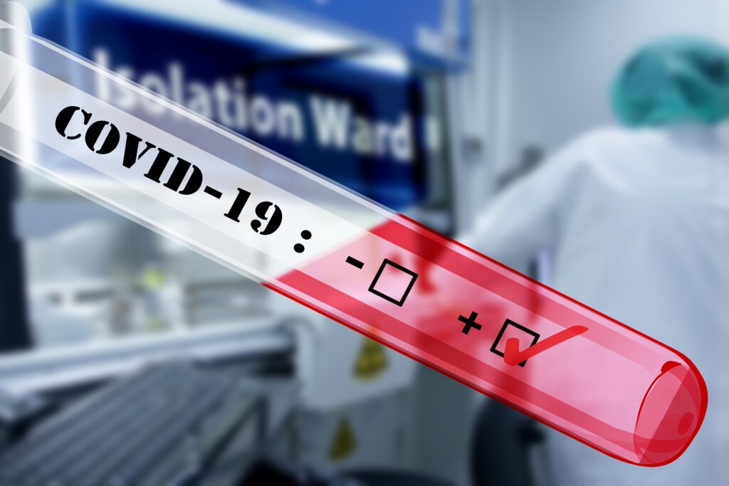 COVID-19 в Запорожской области: за сутки новых случая