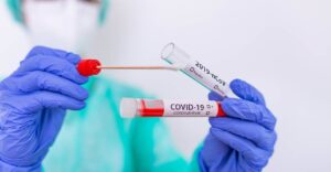 Заболеваемость COVID-19 в Запорожской области: за сутки 294 новых случая