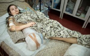 Пострадавшую от обстрела девочку из Полог эвакуировали в Германию