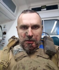 Режисер Олег Сенцов отримав бойове поранення на Запорізькому напрямку