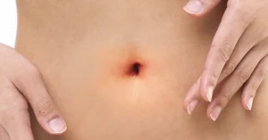 Можно ли ковырять пупок: правда и популярные заблуждения