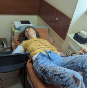 Запорожская мастерица Наталья Матвеева пострадала во время удара по ДнепроГЭС